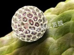 尖锐湿疣病毒检查都有哪几种方法呢?