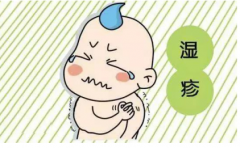 婴儿得了湿疹应当怎么治疗才能更好的去除呢?